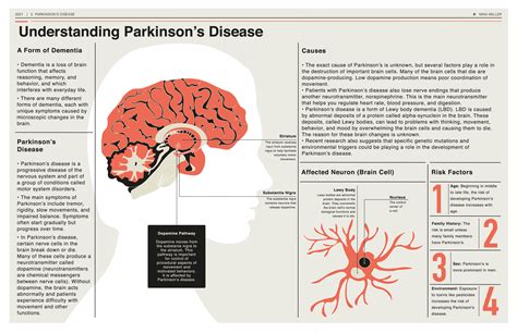 parkinson's and memory loss
